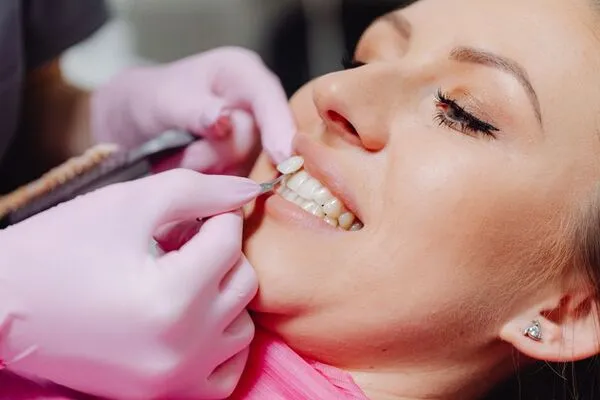 Detalhe de um atendimento odontológico estético com facetas dentárias